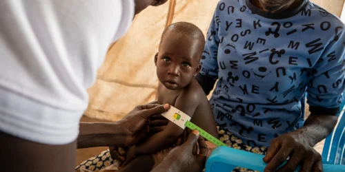 Ett barn i Sydsudan får näringsstöd genom Amref Health Africas arbete mot hunger och undernäring.